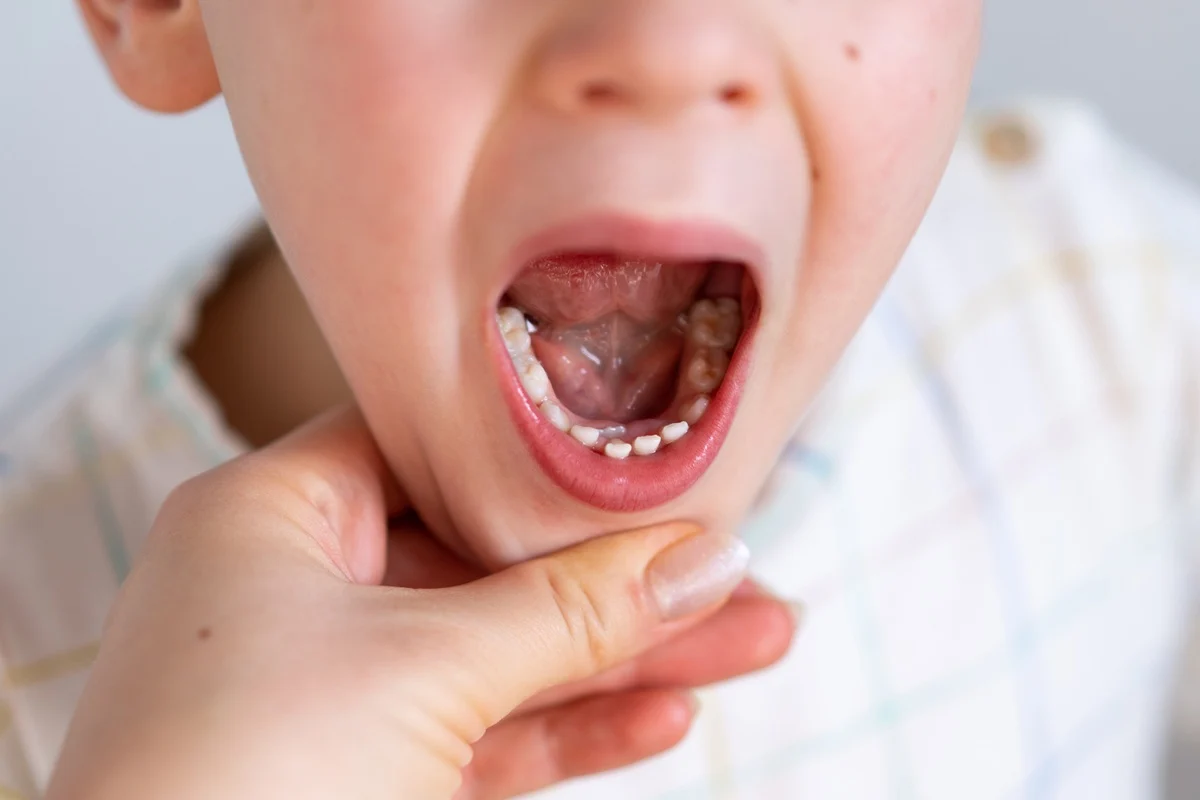 children at Boca Delray Pediatric Dentistry